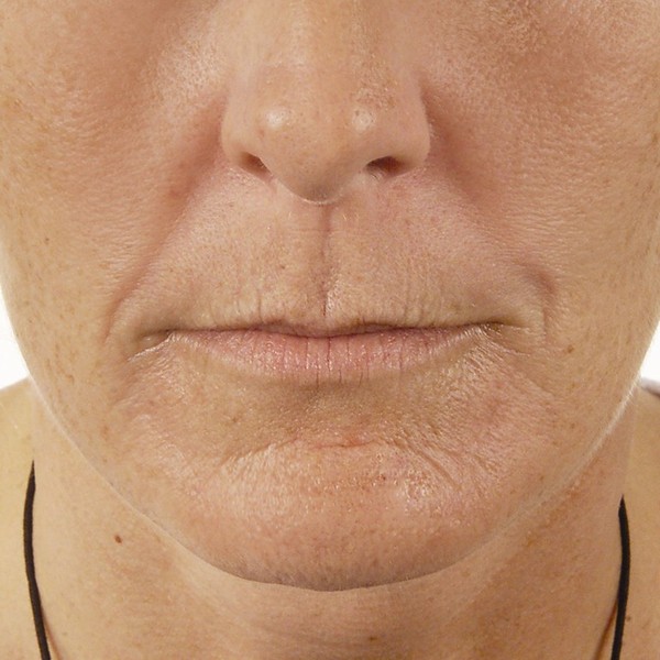 cache_2422657158 cache_2422657158