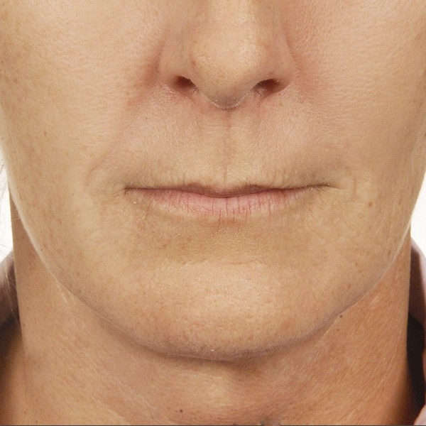 cache_2422657159 cache_2422657159