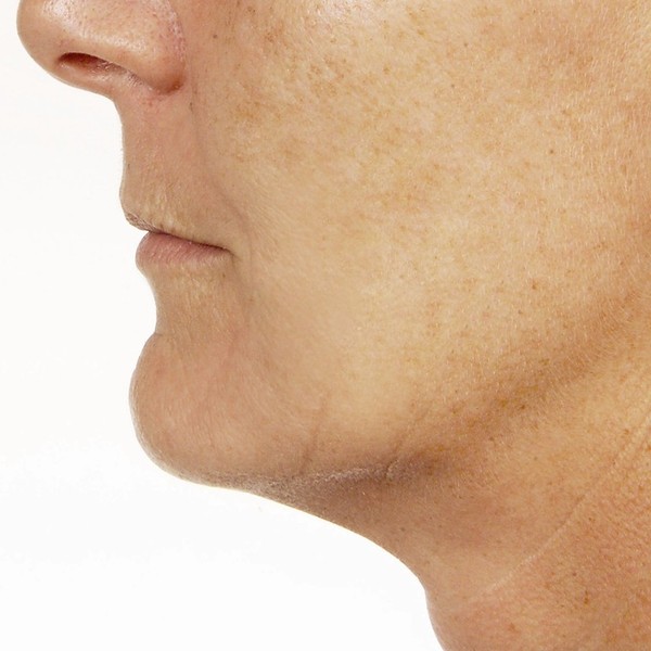 cache_2422657161 cache_2422657161